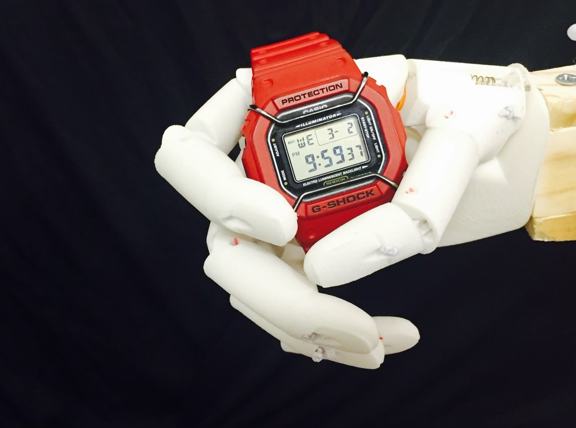 Bionic hand with a wrist watch